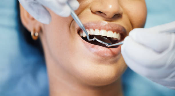 Best Emergency Treatment for Oral Infections in Greensboro, NC